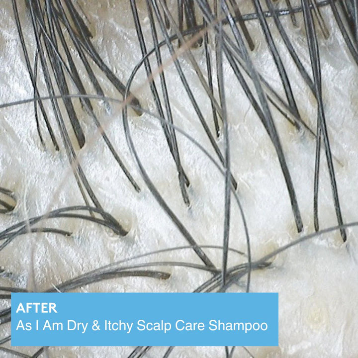 As I Am Dry & Itchy Scalp Care Olive & Tea Tree Oil Shampoo