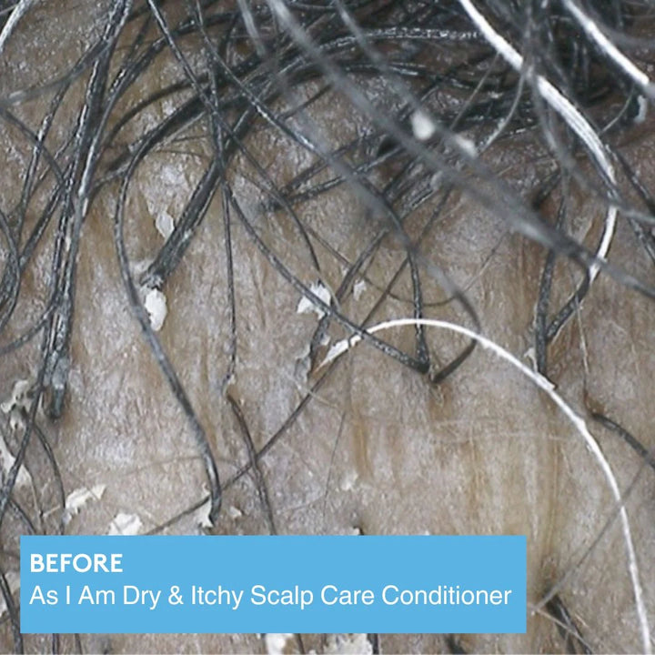 As I Am Dry & Itchy Scalp Care Olive & Tea Tree Oil Conditioner