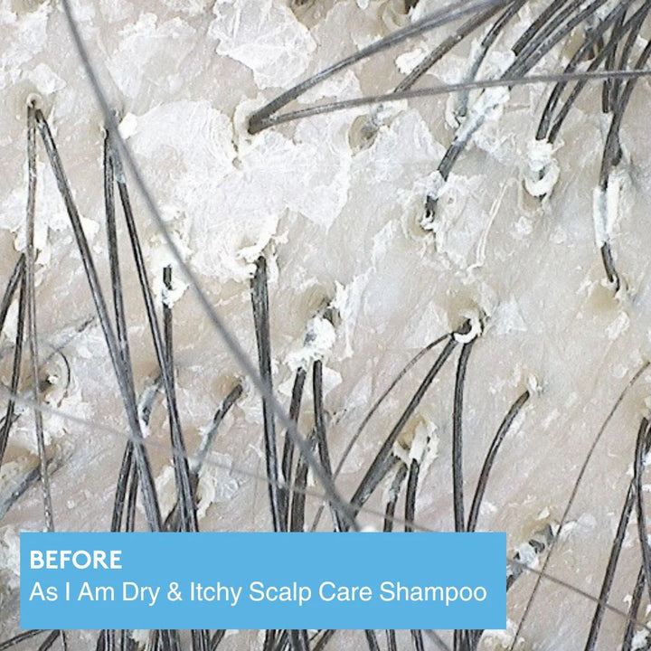 As I Am Dry & Itchy Scalp Care Olive & Tea Tree Oil Shampoo